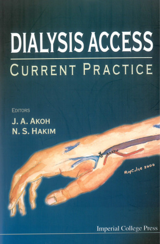 Dialysis access: current practice