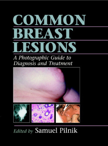 Common Breast Lesions: A Photographic Guide to Diagnosis and Treatment