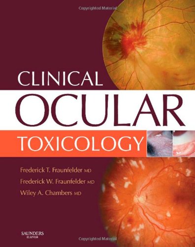 Clinical Ocular Toxicology: Drug-Induced Ocular Side Effects