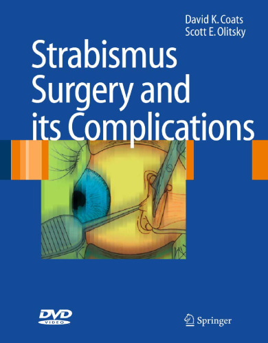 Strabismus Surgery and its Complications