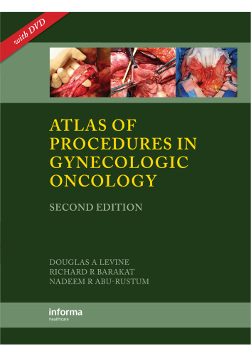 Atlas of Procedures in Gynecologic Oncology, Second Edition