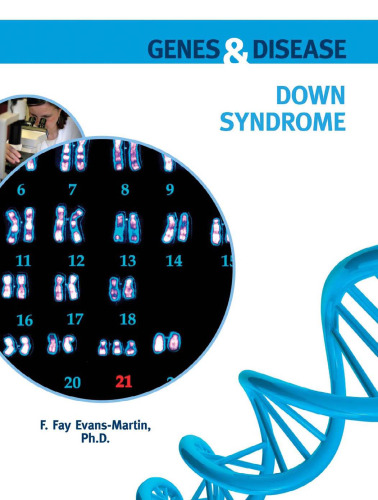 Down Syndrome (Genes and Disease)