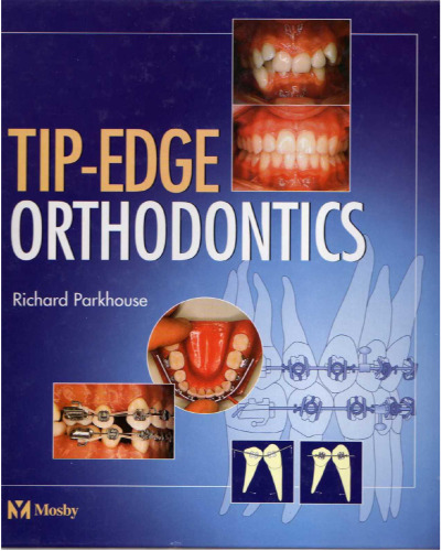 The Tip-Edge Orthodontic System