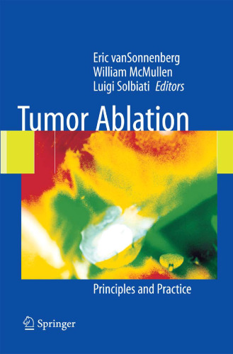 Tumor Ablation: Principles and Practice