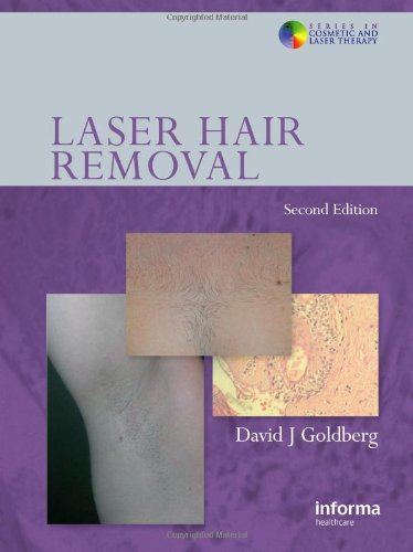 Laser Hair Removal, Second Edition (Series in Cosmetic and Laser Therapy)