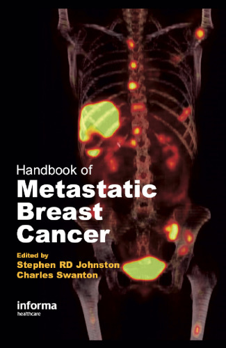 Handbook of Metastatic Breast Cancer