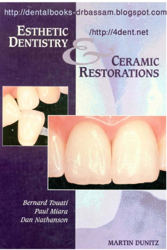 Esthetic Dentistry and Ceramic Restorations
