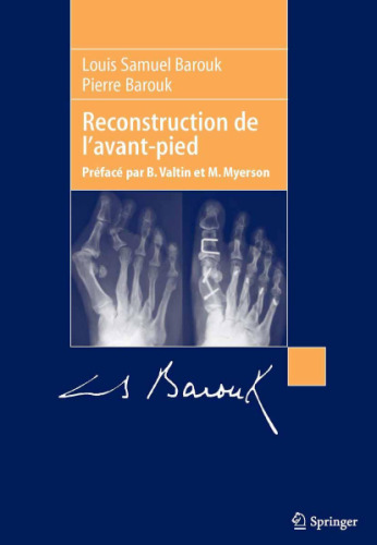 Reconstruction de l'avant-pied