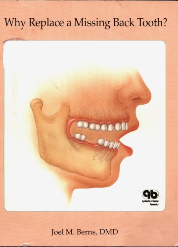 Why Replace a Missing Back Tooth (Educate Your Patients)