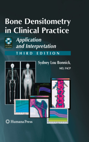 Bone Densitometry in Clinical Practice: Application and Interpretation