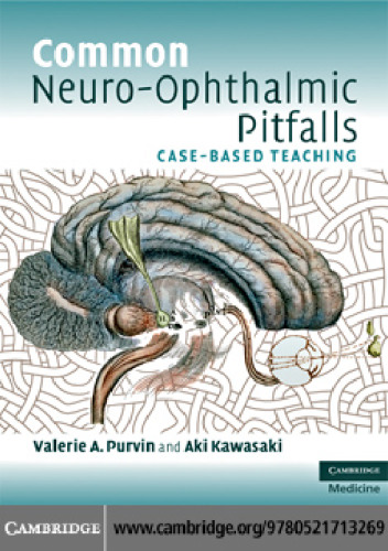 Common Neuro-Ophthalmic Pitfalls: Case-Based Teaching