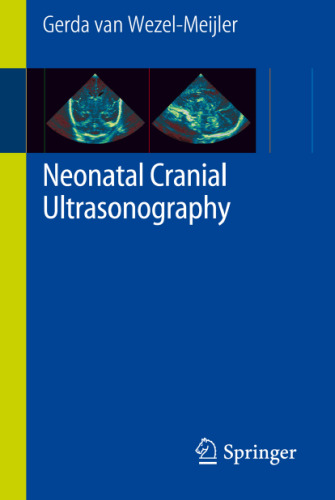 Neonatal Cranial Ultrasonography: Guidelines for the Procedure and Atlas of Normal Ultrasound Anatomy