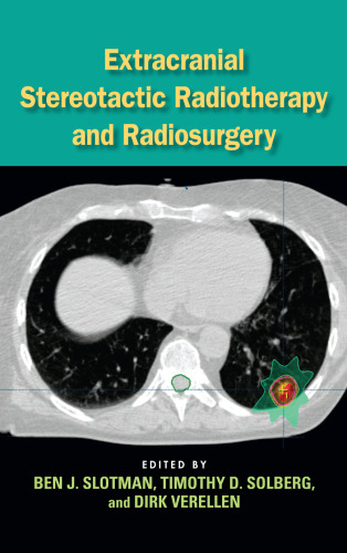Extracranial Stereotactic Radiotherapy and Radiosurgery