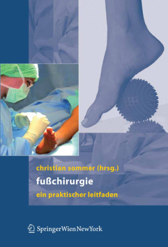 Fußchirurgie: Ein praktischer Leitfaden