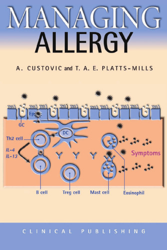 Managing Allergy