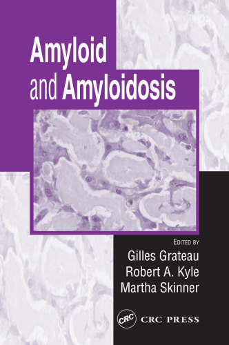 Amyloid and Amyloidosis