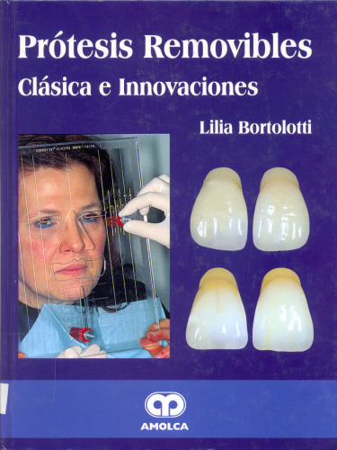 Prótesis removibles Clásica e innovaciones  Spanish