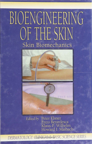 Bioengineering of the Skin: Skin Biomechanics (Dermatology Clinical & Basic Science)