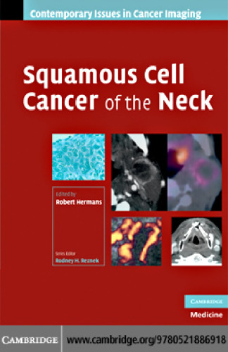 Squamous Cell Cancer of the Neck (Contemporary Issues in Cancer Imaging)