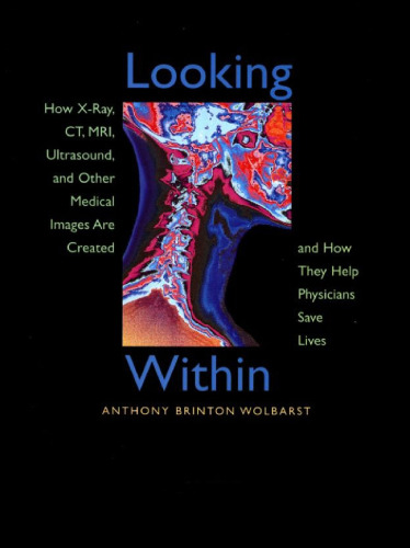 Looking Within: How X-Ray, CT, MRI, Ultrasound, and Other Medical Images Are Created, and How They Help Physicians Save Lives