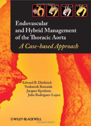 Endovascular and Hybrid Management of the Thoracic Aorta: A Case-based Approach
