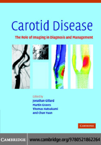 Carotid Disease: The Role of Imaging in Diagnosis and Management