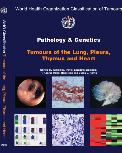 Pathology and Genetics of Tumours of the Lung, Pleura, Thymus and Heart (WORLD HEALTH ORGANIZATION CLASSIFICATION OF TUMOURS)