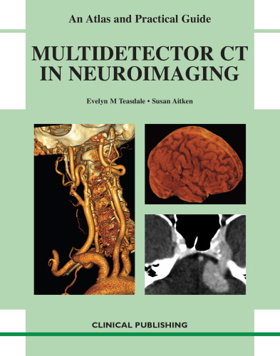 Multidetector CT in Neuroimaging: An Atlas and Practical Guide