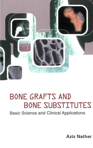 Bone Grafts and Bone Substitutes: Basic Science and Clinical Applications