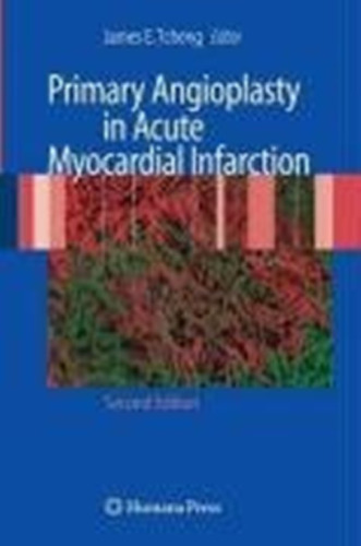 Primary Angioplasty in Acute Myocardial Infarction: Second Edition