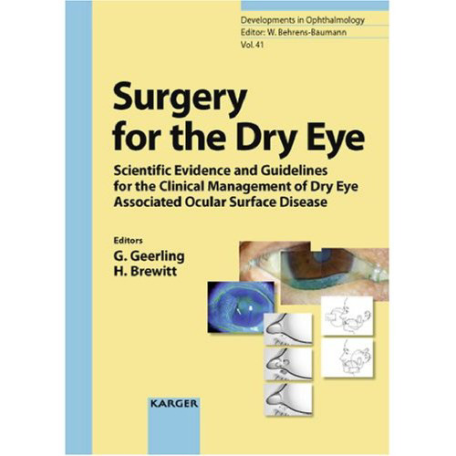 Surgery for the Dry Eye: Scientific Evidence and Guidelines for the Clinical Management of Dry Eye Associated Ocular Surface Disease (Developments in Ophthalmology, Vol. 41)