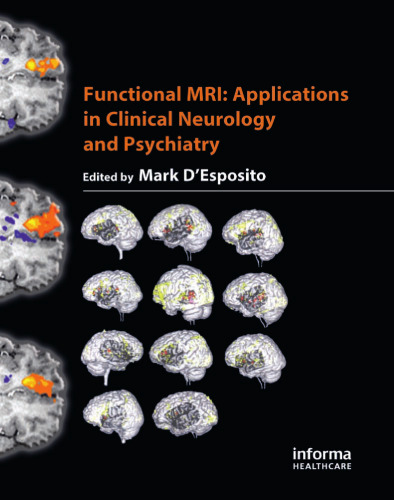 Functional MRI: Applications in Clinical Neurology and Psychiatry