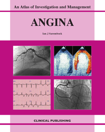 Angina: An Atlas of Investigation and Management