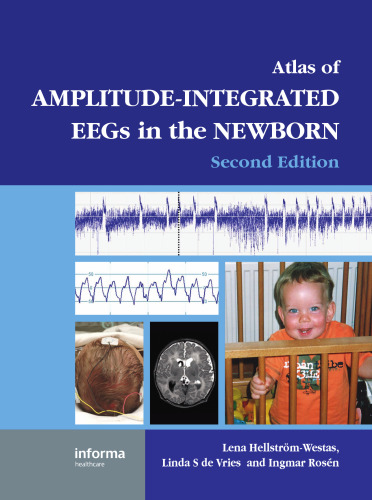 An Atlas of Amplitude-Integrated EEGs in the Newborn (2nd Edition) (Encyclopedia of Visual Medicine Series)