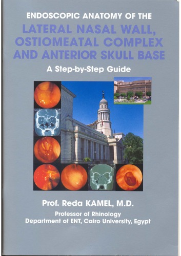 Endoscopic Anatomy of the Lateral Nasal Wall, Ostiomeatal Complex and Anterior Skull Base: A Step-by-Step Guide