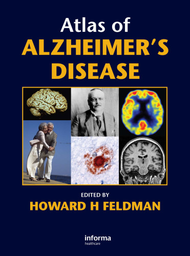 Atlas of Alzheimer's Disease