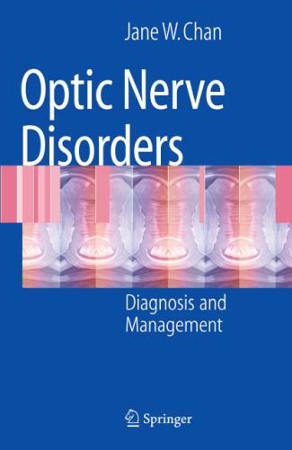 Optic Nerve Disorders: Diagnosis and Management