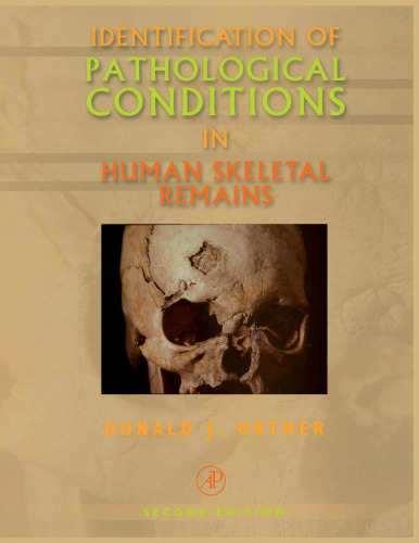 Identification of Pathological Conditions in Human Skeletal Remains, Second Edition