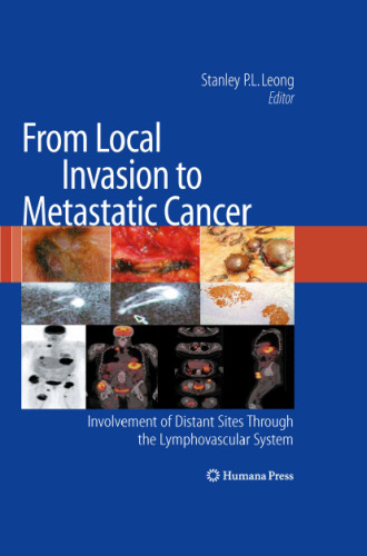 From Local Invasion to Metastatic Cancer: Involvement of Distant Sites Through the Lymphovascular System
