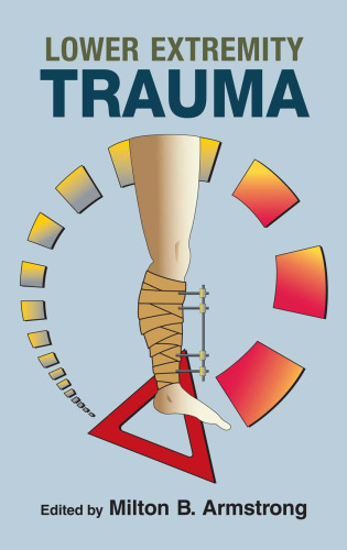 Lower Extremity Trauma