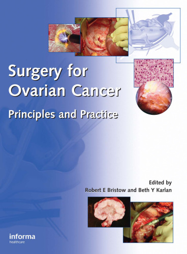 Surgery for Ovarian Cancer: Principles and Practice