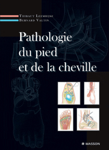 Pathologie du pied et de la cheville