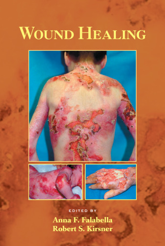 Wound Healing (Basic and Clinical Dermatology)