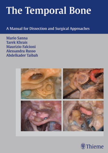 The Temporal Bone: A Manual for Disection and Surgical Approaches