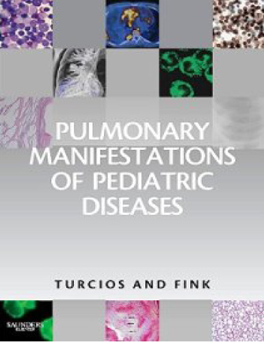 Pulmonary Manifestations of Pediatric Diseases