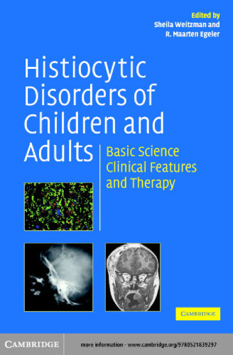 Histiocytic disorders of children and adults
