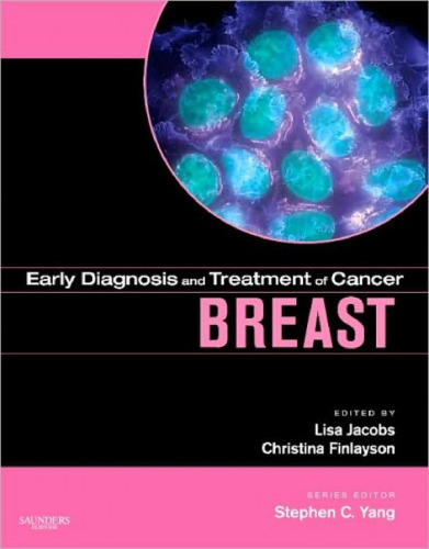 Early Diagnosis and Treatment of Cancer Series: Breast Cancer: Expert Consult - Online and Print (Early Diagnosis in Cancer)
