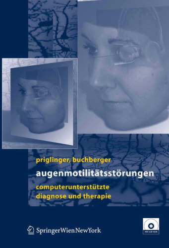 Augenmotilitätsstörungen: Computerunterstütze Diagnose und Therapie
