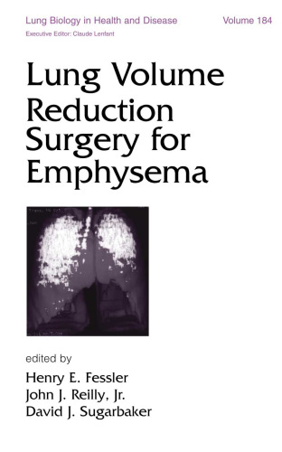 Lung Biology in Health & Disease Volume 184 Lung Volume Reduction Surgery for Emphysema