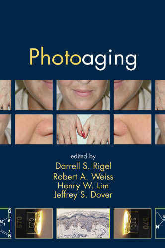 Photoaging (Basic and Clinical Dermatology)